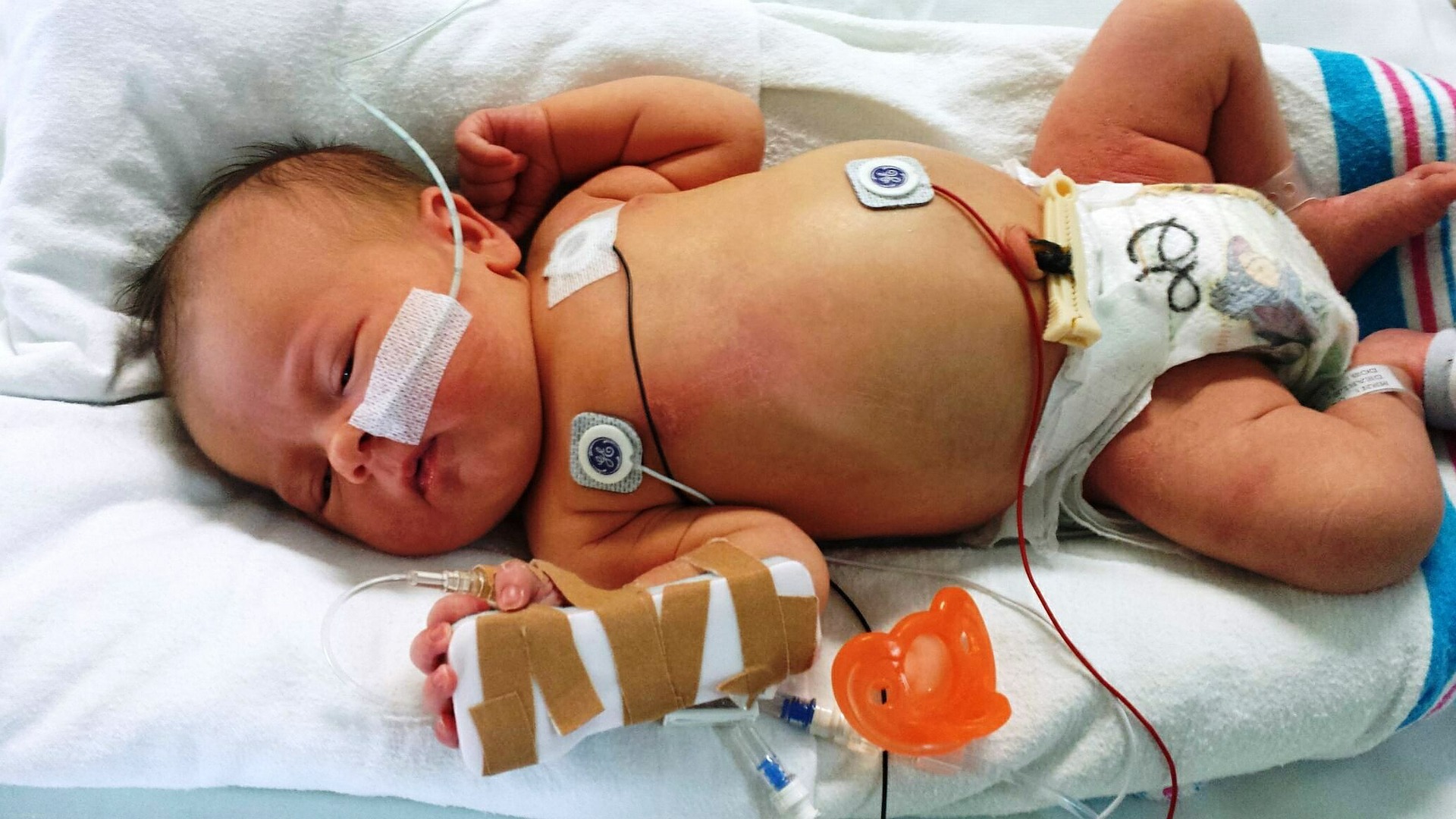 Saving Lives of Premature Babies